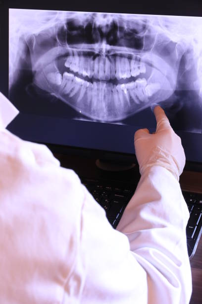 Best Emergency Denture Repair in Espy, PA
